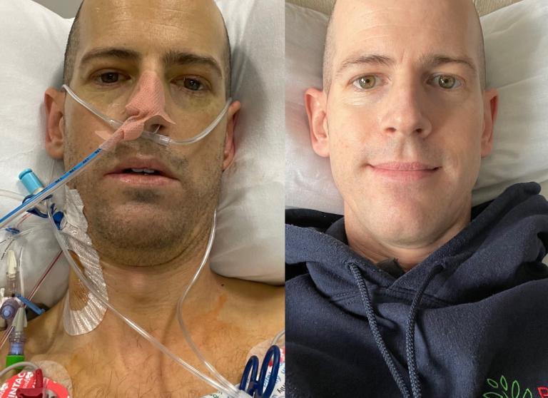 before and after transplant pictures of Gareth Weeks 