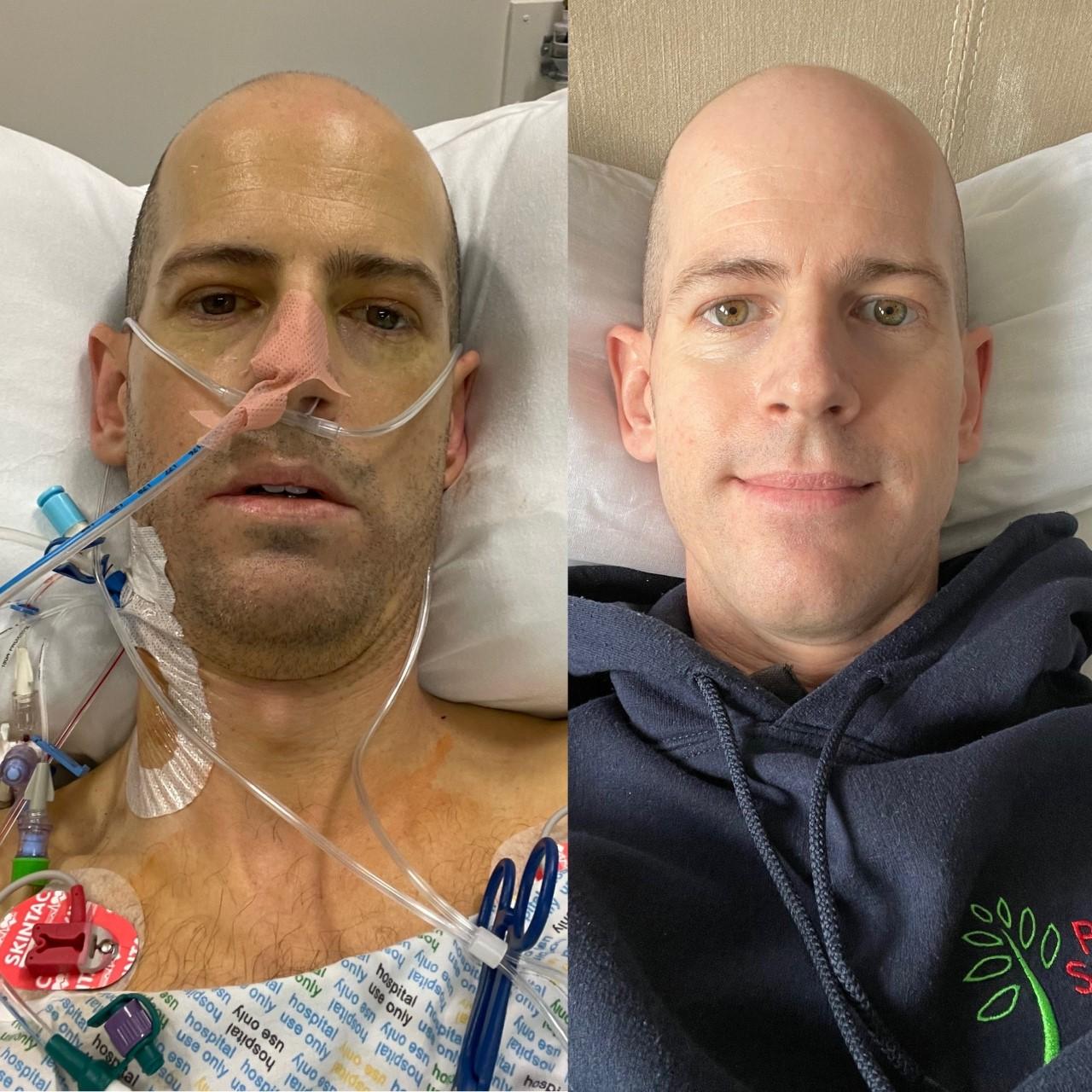 The Scottish Liver Transplant Unit marks 30th anniversary | Organ Donation Scotland